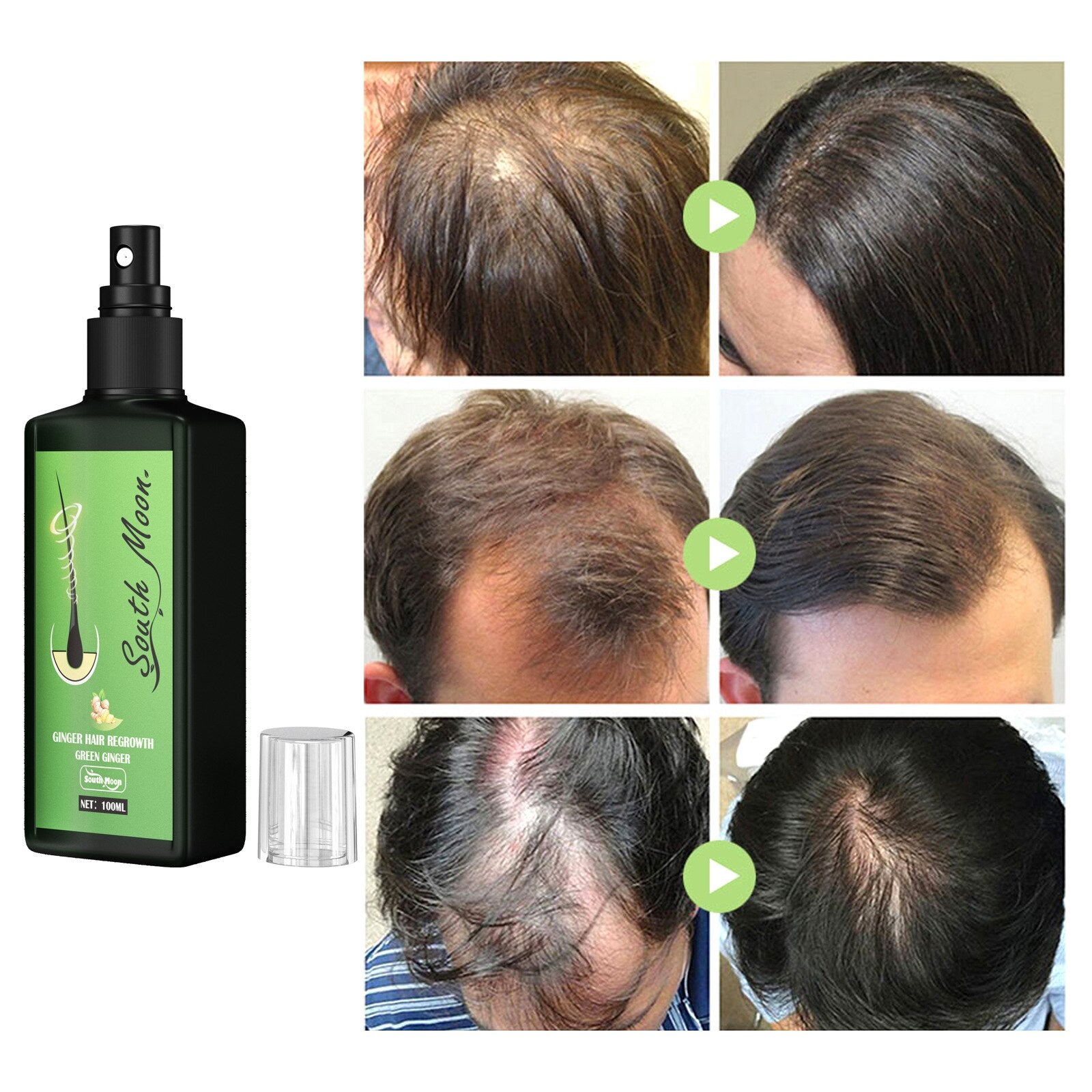 GrowthPlus™ Nourishing Ginger Spray