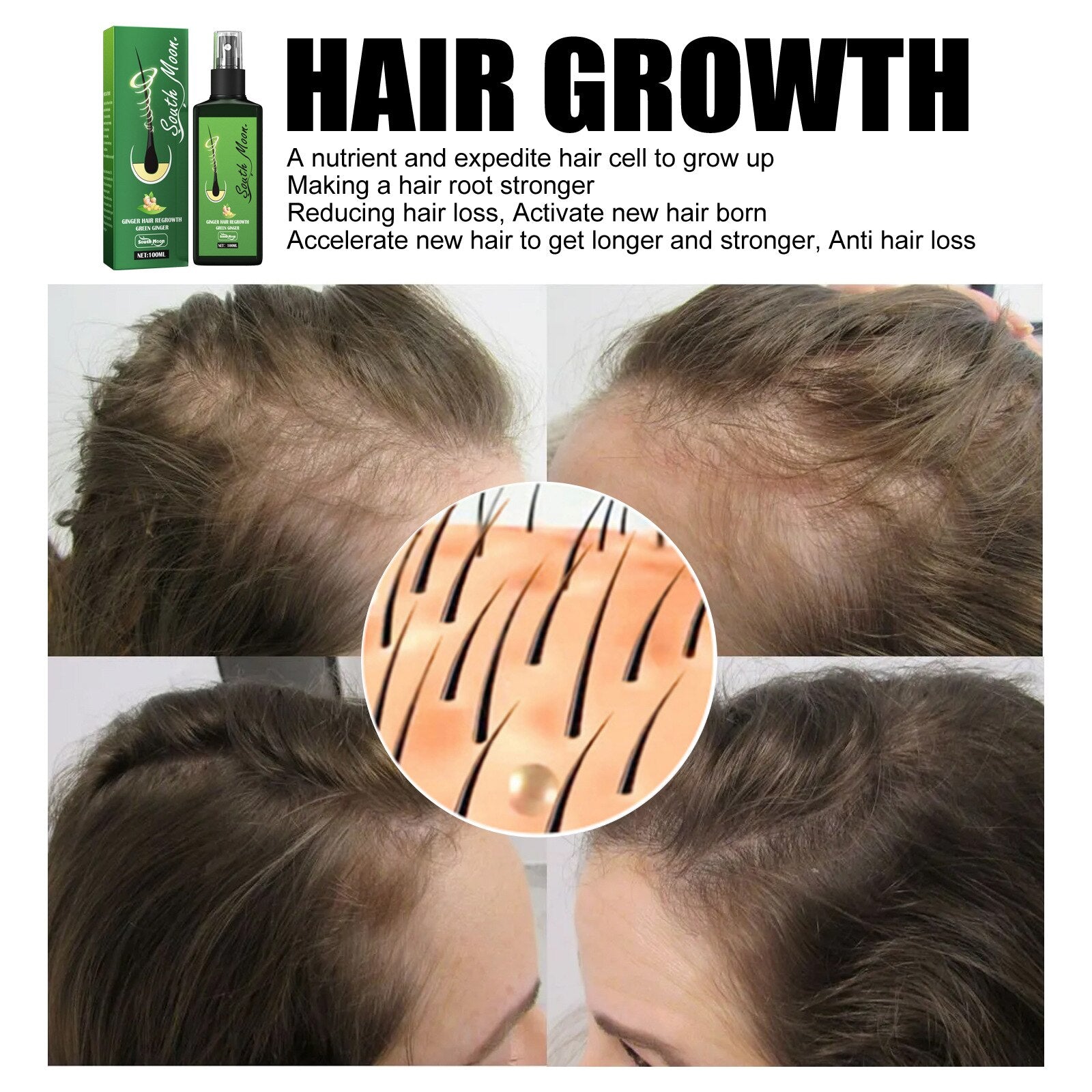 GrowthPlus™ Nourishing Ginger Spray